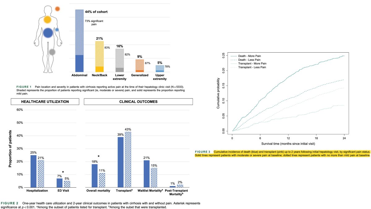 1 de cada 4 pacientes con #cirrosis tienen dolor moderado/severo: 🇺🇸 n=5333 👀 Especialmente a nivel abdominal (44%) 💊 Uso frecuente de analgésicos (>50%), sobre todo opioides 🏥 El dolor significativo se asoció a un mayor uso de recursos sanitarios, como visitas a urgencias y