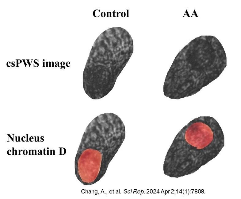 Investigators @NorthwesternU #CCBIR developed an approach using microscopy and #ArtificialIntelligence to examine nanoscale chromatin 3D architecture, which enables the early screening of #ColorectalCancer @SciReports nature.com/articles/s4159….