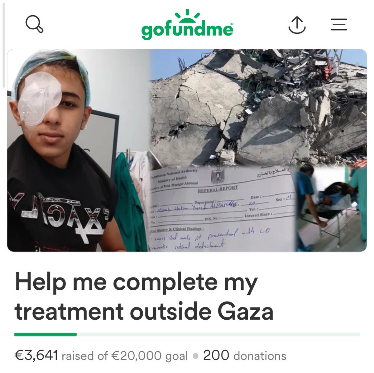 It has been 76 days since I launched my campaign. I have not achieved a quarter of the goal. Even if someone had cared about my urgent humanitarian situation, I would have saved my eyes but there is still hope. I hope you can help with anything you can do. gofundme.com/f/help-me-comp…