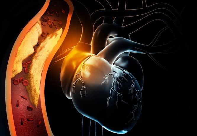 Hilo 🧵 Momentos históricos del tratamiento del #infarto en #cardiología 🫀📚