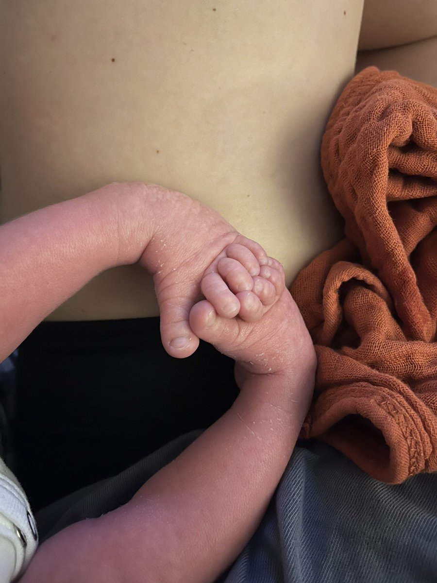 Chelsteezee's tweet photo. My son was born with bilateral club feet. We start the long process of getting them corrected next week but in the meantime look at these little toe beans!! I’m obsessed with them and am going to cry my eyes out at the orthopedists office next week. https://t.co/ORB19IT0ku