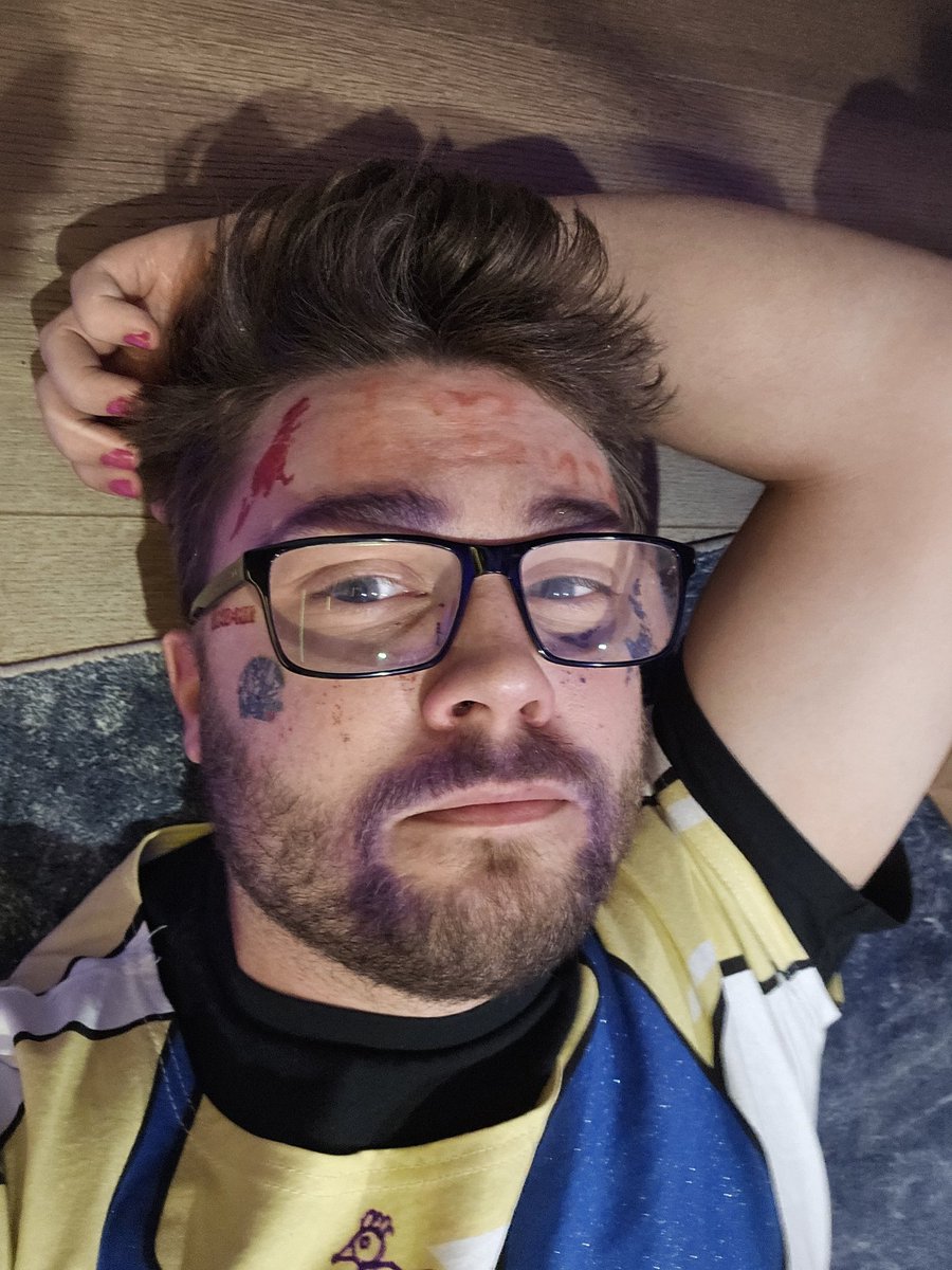 JaWoodle's tweet photo. 12 hours to raise $45,000+ for cancer research
Before <<<<< >>>>> After https://t.co/bBbWjwTU2w