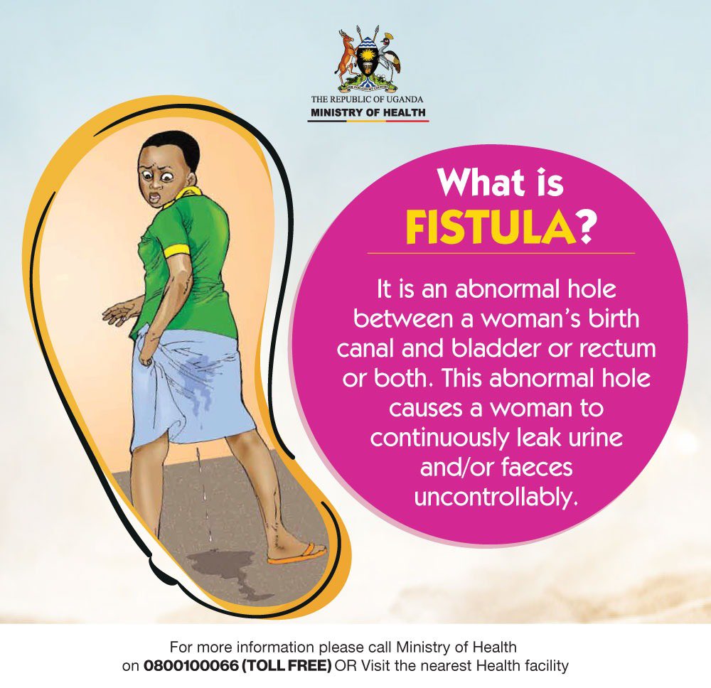 In the aftermath of International Fistula Day on May 23rd, it's crucial that we continue to raise awareness about this condition, promote education and understanding, and support efforts to provide medical treatment and care to those affected. #EndFistulaUG