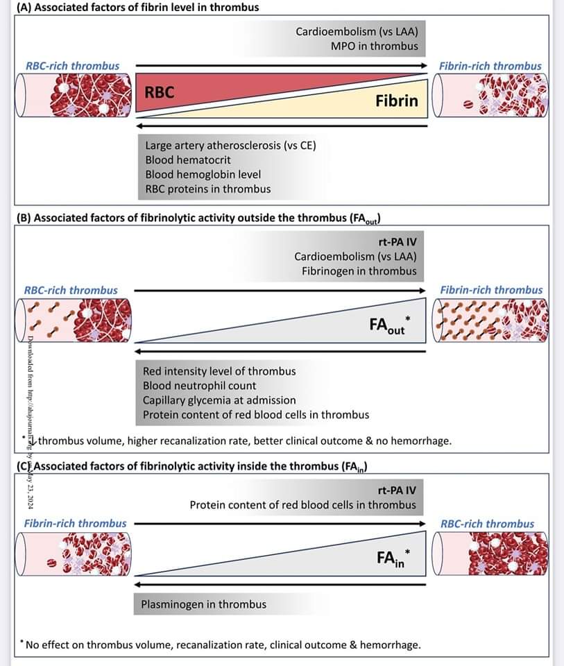 🔴How clot composition influences fibrinolysis in the acute phase of stroke: a proteomic study of cerebral thrombi #OpenAccess ✅ahajournals.org/doi/abs/10.116… #medtwitterWhat #MedTwitter #CardioEd #medx #medEd #CardioTwitter #cardiotwitter #MedX #MedEd #cardiology #cardiotwiteros