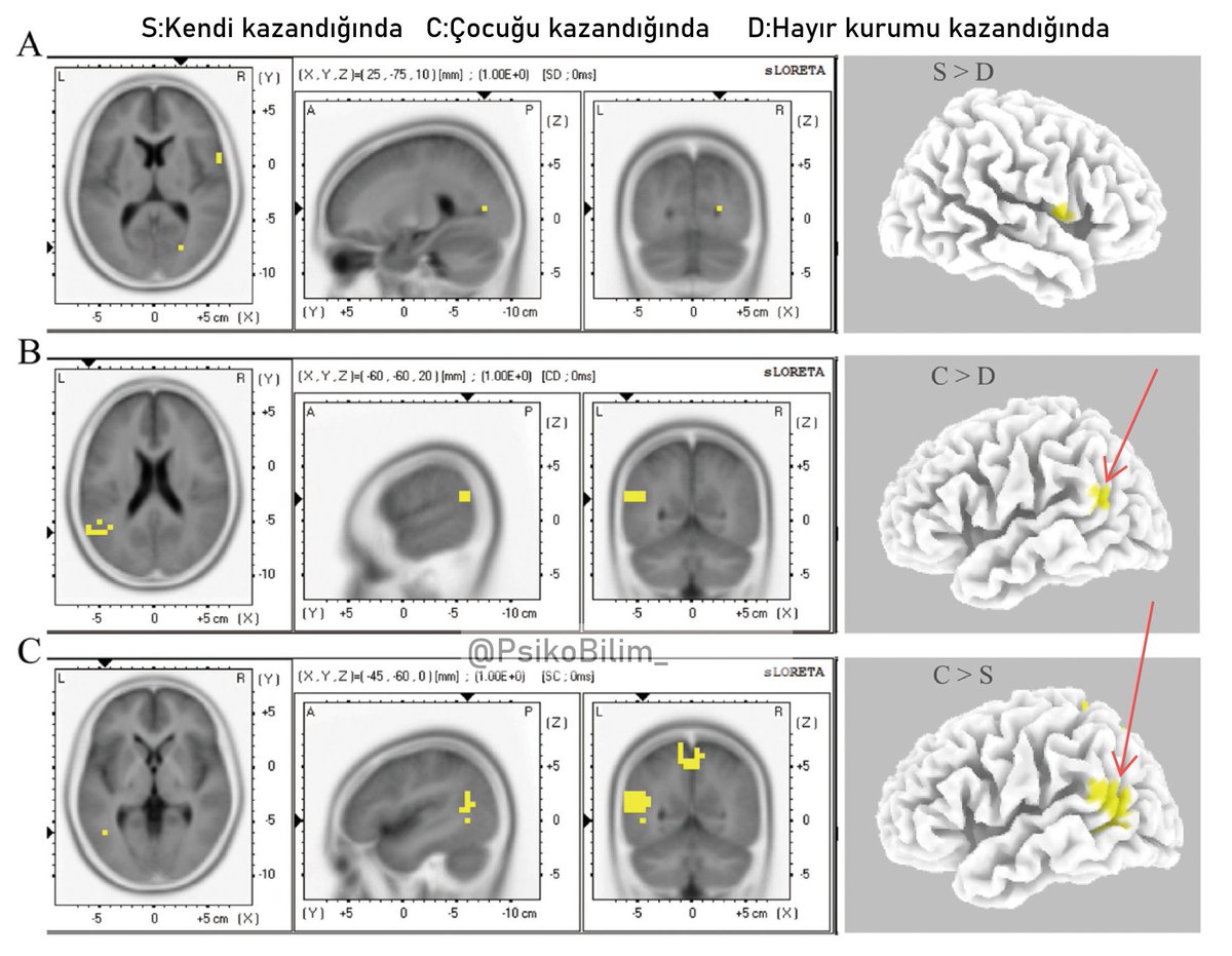 Bir annenin beyni çocuğu bir ödül kazandığında kendi ödül kazandığından daha fazla aktif oluyor.