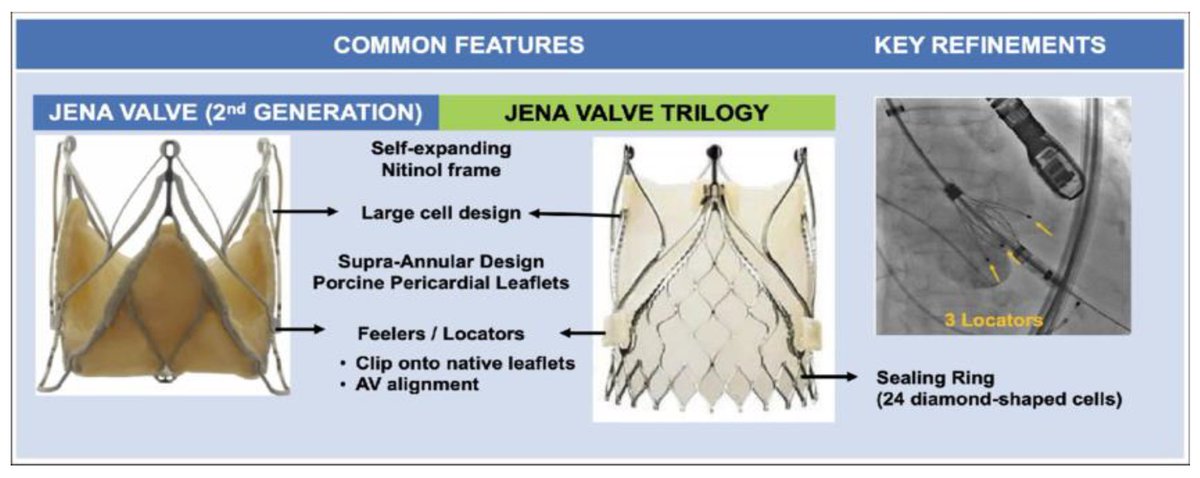 🔴Transcatheter Aortic Valve Implantation for Severe Chronic Aortic Regurgitation
 #OpenAccess  #2024Review 
 
✅mdpi.com/2077-0383/13/1…
 #medtwitterWhat #MedTwitter #CardioEd #medx #medEd #CardioTwitter #cardiotwitter #MedX #MedEd #cardiology #cardiotwiteros #FOAMed #medicine