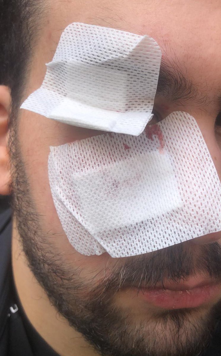 Un dimanche normal à #stalincrack
Ce monsieur a été agressé par un toxico (⚠️casquette rouge 🚇 Jaurès) 
Il lui a demandé de s’écarter car il se battait avec un autre et son neveu avait peur de passer. Paris est abandonné aux asso complices avec notre💰 #saccageparis <a href="/CNEWS/">CNEWS</a>