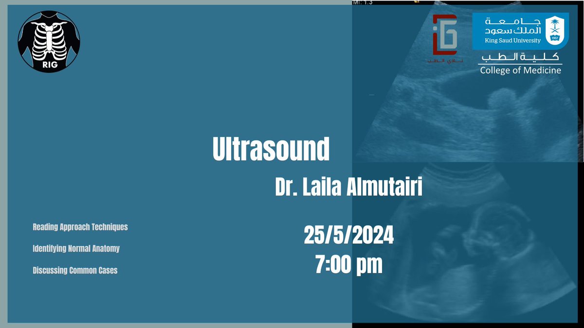 RadiologyIG_KSU's tweet photo. Join our seventh and last workshop titled Ultrasound now via the following links: 

Zoom:
https://t.co/8pUzEhwGfF

YouTube Live:
https://t.co/8mQ0TgEyfK

We will begin at 7:10 PM https://t.co/QV0qQt8tcu