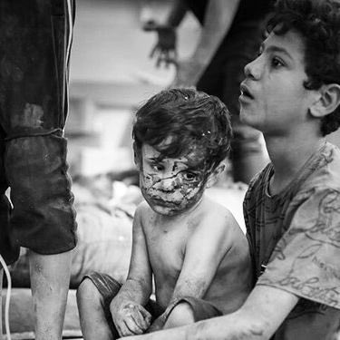 Children lack medical care after air strikes. Children in Gaza face a lack of medical services and food. I hope you can lend your love to help them. Donation link: wgjysjy.com/Home/Item/inde…