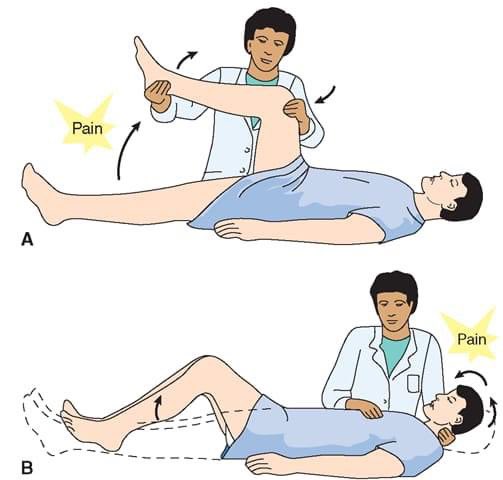 #sign

What is the name of this signs (A&B)?
What is the diagnosis?

#MedEd 
#MEDHM 
#MedX 
@IhabFathiSulima