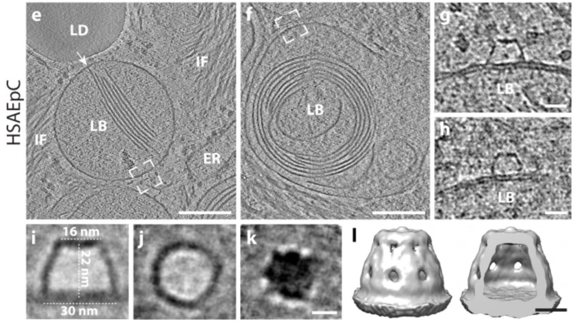 jankosinski's tweet photo. Another amazing flotillin structure. Is this the same complex as @ChlandaL observed in 2021 on lamellar bodies but could not identify? Dimensions match! https://t.co/LxSY7ybzUf https://t.co/rvfH62MSTR