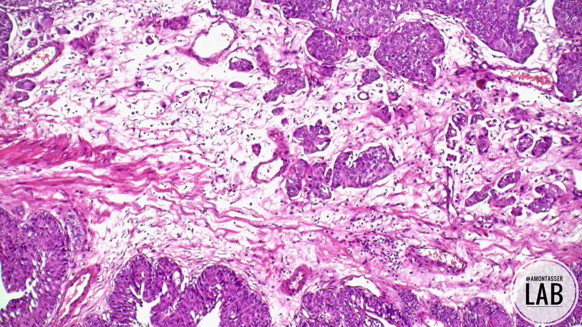 🔬HGPUC, T1 👌🏽 #GUpath #PathX #PathTwitter #Pathology