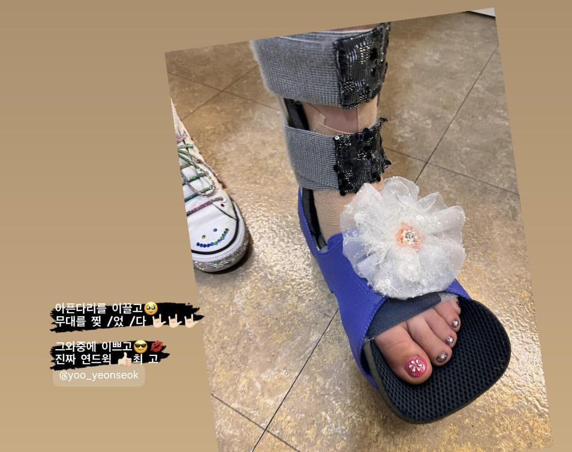 Yoo Yeonseok’s leg brace embellished with flowers, showing his pretty painted toe nails. 🌸✨

The love, care and attention to detail he has put into ensuring a cohesive and seamless storyline is incredible.

You’re a real trooper, Yeonseokie. Get well soon. 🥹

📸 YYS’ stylist