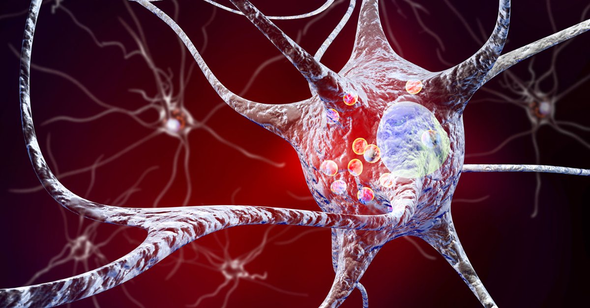 This article reviews the debate about disclosure of risk of progression to Parkinson disease and related disorders to individuals through the perspectives of the pillars of medical ethics: beneficence, nonmaleficence, autonomy, and justice. bit.ly/3QVQ0YQ

#NeuroTwitter