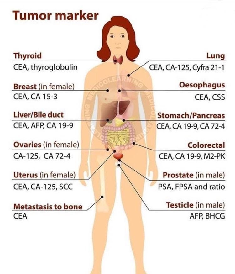 Tumor Marker

#MedEd #MedTwitter #tumormarker