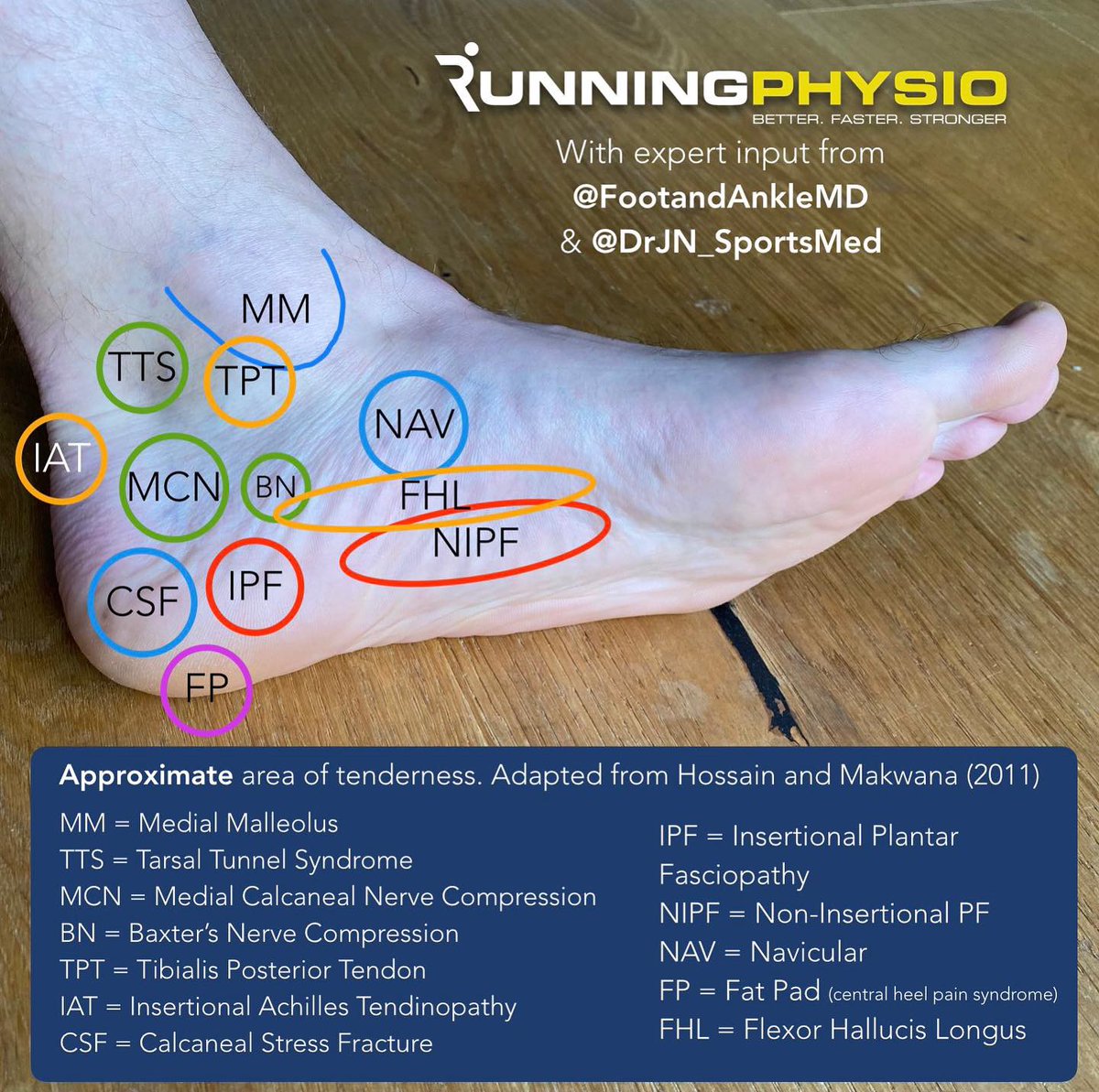 Not all heel pain is Plantar Fasciitis!

Please note pain locations are approximate and will vary between individuals