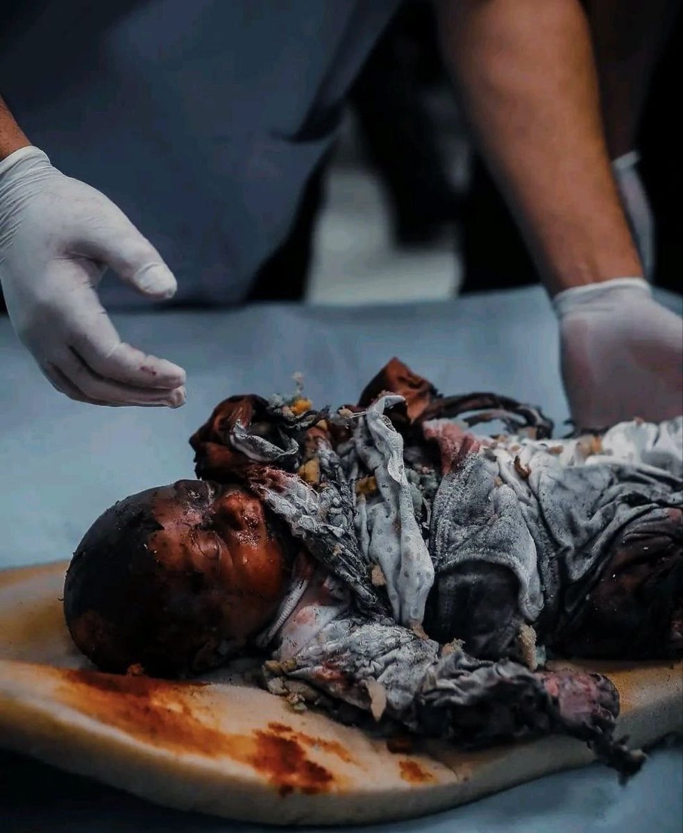 صوره مؤلمة لطفل تفحم بعد قصف الاحتلال مخيم النازحين في رفح #مجزرة_مخيم_النازحين_برفح #مجزرة_رفح