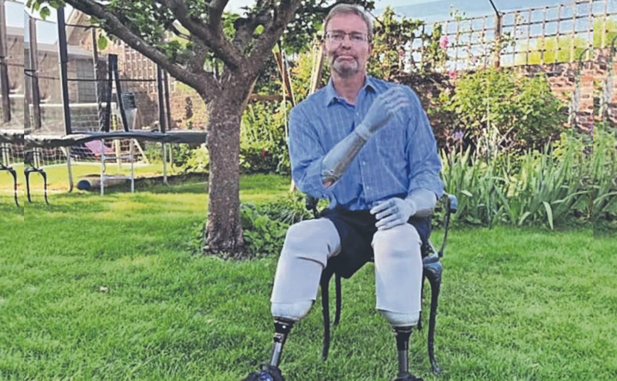 El diputado británico Craig Mackinlay perdió los brazos y las piernas por la gangrena después de recibir 3 dosis de las Pfizer y AstraZeneca en 2021. A él no le preocupa, y volverá a vacunarse en cuanto se lo ordenen. 
¿Aún creen que es posible desengañar a un covidiano?