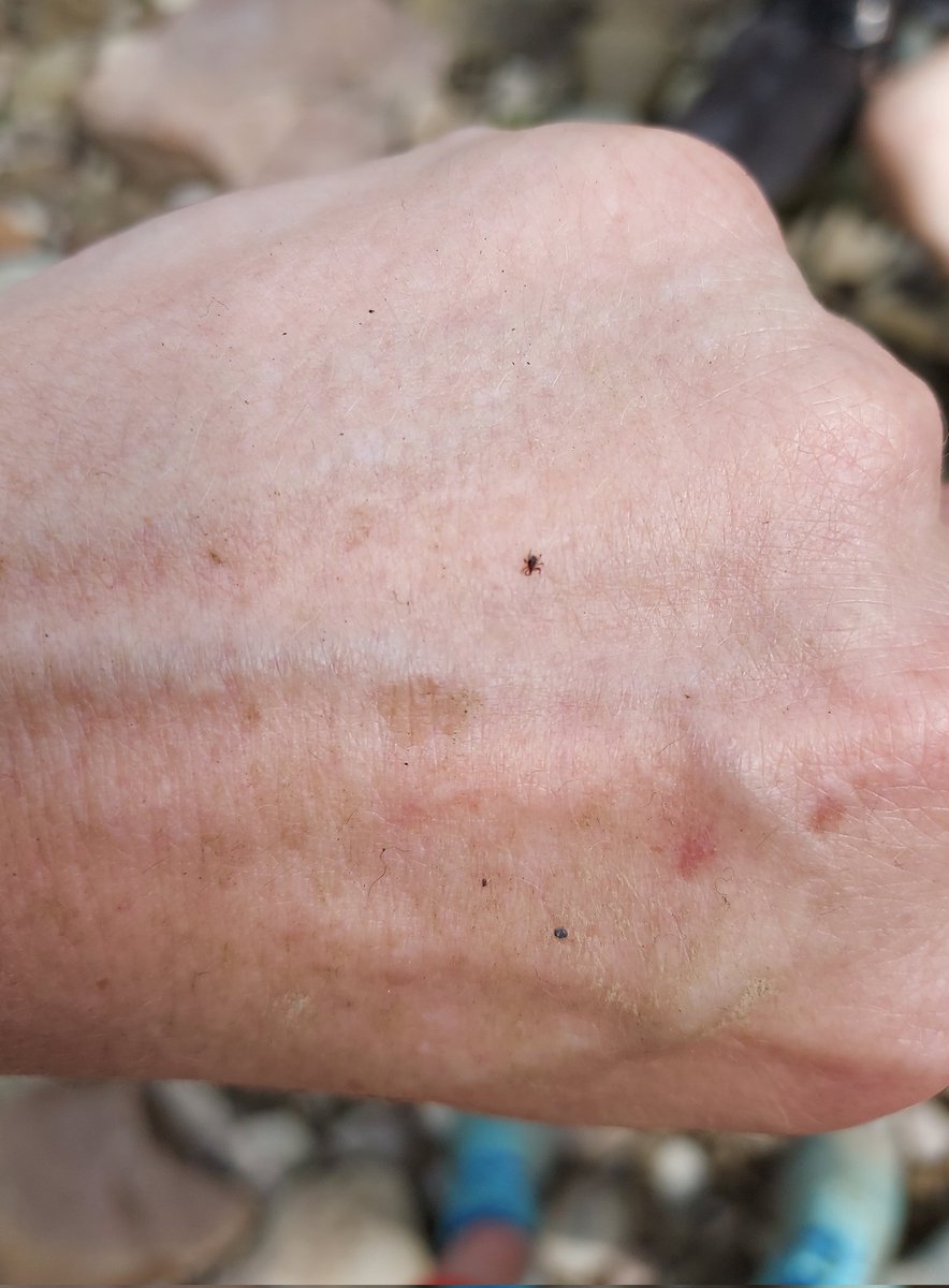 A reminder sans poppy seed muffin about how small #ticks can be. Hiking today and this asshole thought they were hitching a ride. Compare to the speck of dirt at the bottom.