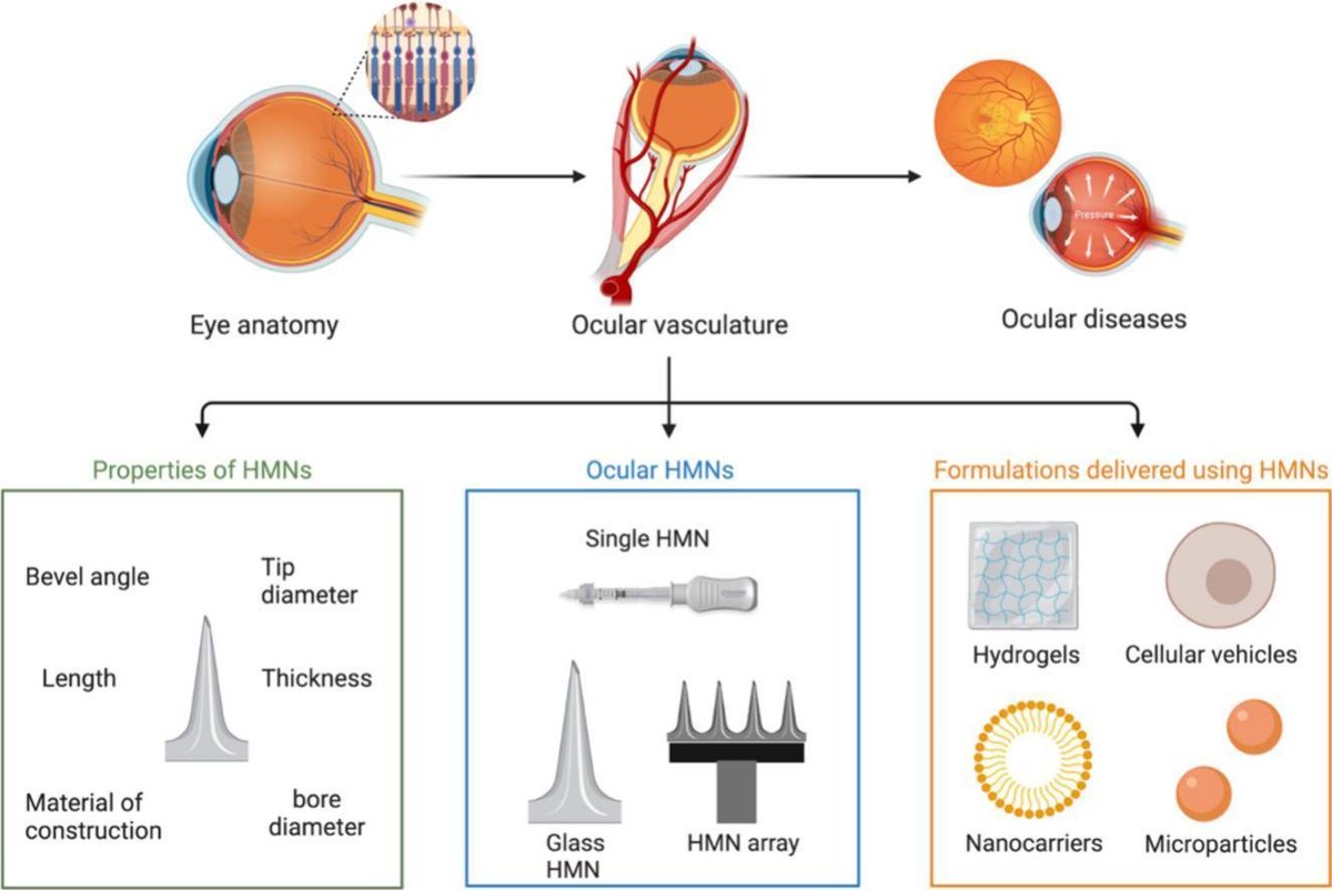 Hollow microneedles for ocular drug delivery. | Raghu Raj Singh Thakur @pharmacyatQUB | @UKICRS #microneedle #ocular #suprachoroidal doi.org/10.1016/j.jcon…