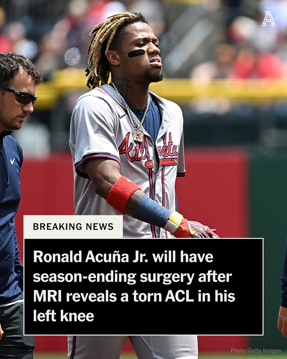 Ronald Acuña Jr. has a complete tear of the ACL in his left knee and will have season-ending surgery, the Atlanta Braves announced.