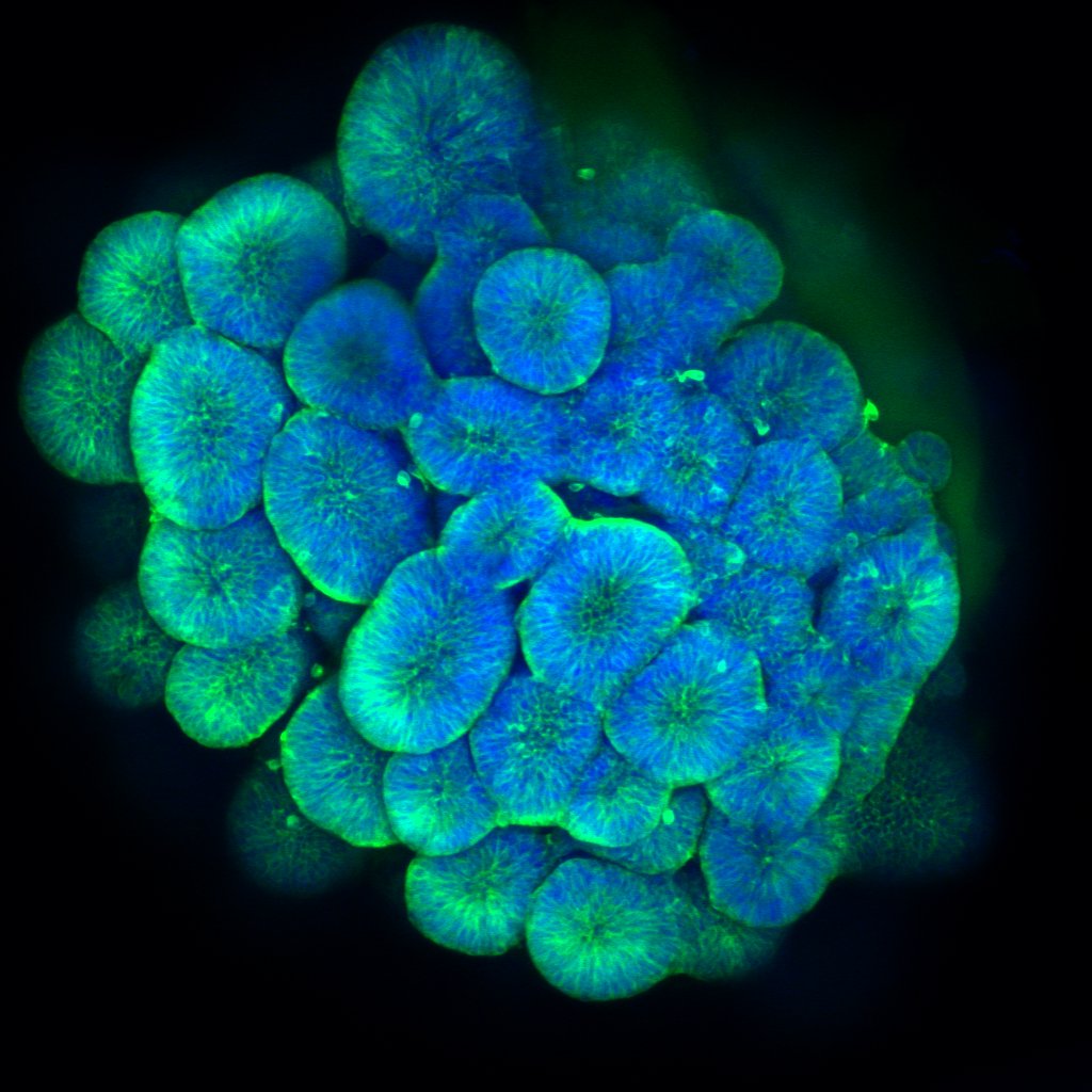 If you are motivated for a PhD, don't hesitate to contact us and apply to BSB doctoral school competition ed-bsb.univ-toulouse.fr/as/ed/voirprop…. We have neural organoids for analysis to elucidate the role of EFNB1 in human brain formation and CFNS. cbi-toulouse.fr/fr/equipe-davy. #organoid