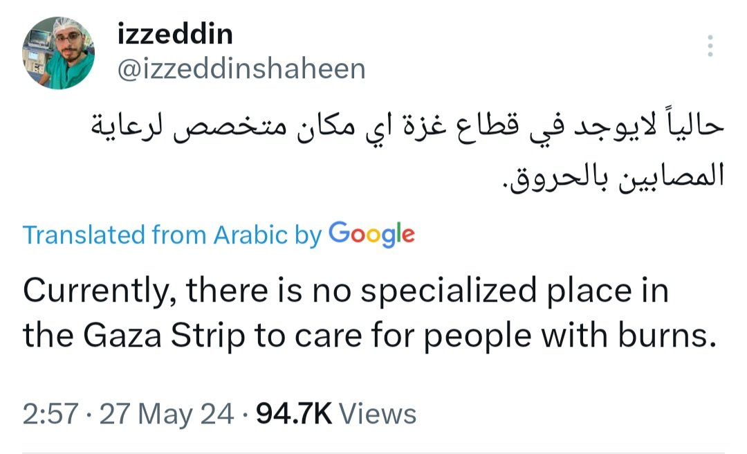 @GiuseppeConteIT @elvira50913 Le ustioni sono dolorosissime,si infettano subito e Gaza non ci sono anestetici né antibiotici n'è null'altro di cio' che serve per curare e alleviare le sofferenze 
#Israele è un'organizzazione criminale mostruosa e disumana #dismantleIsrael