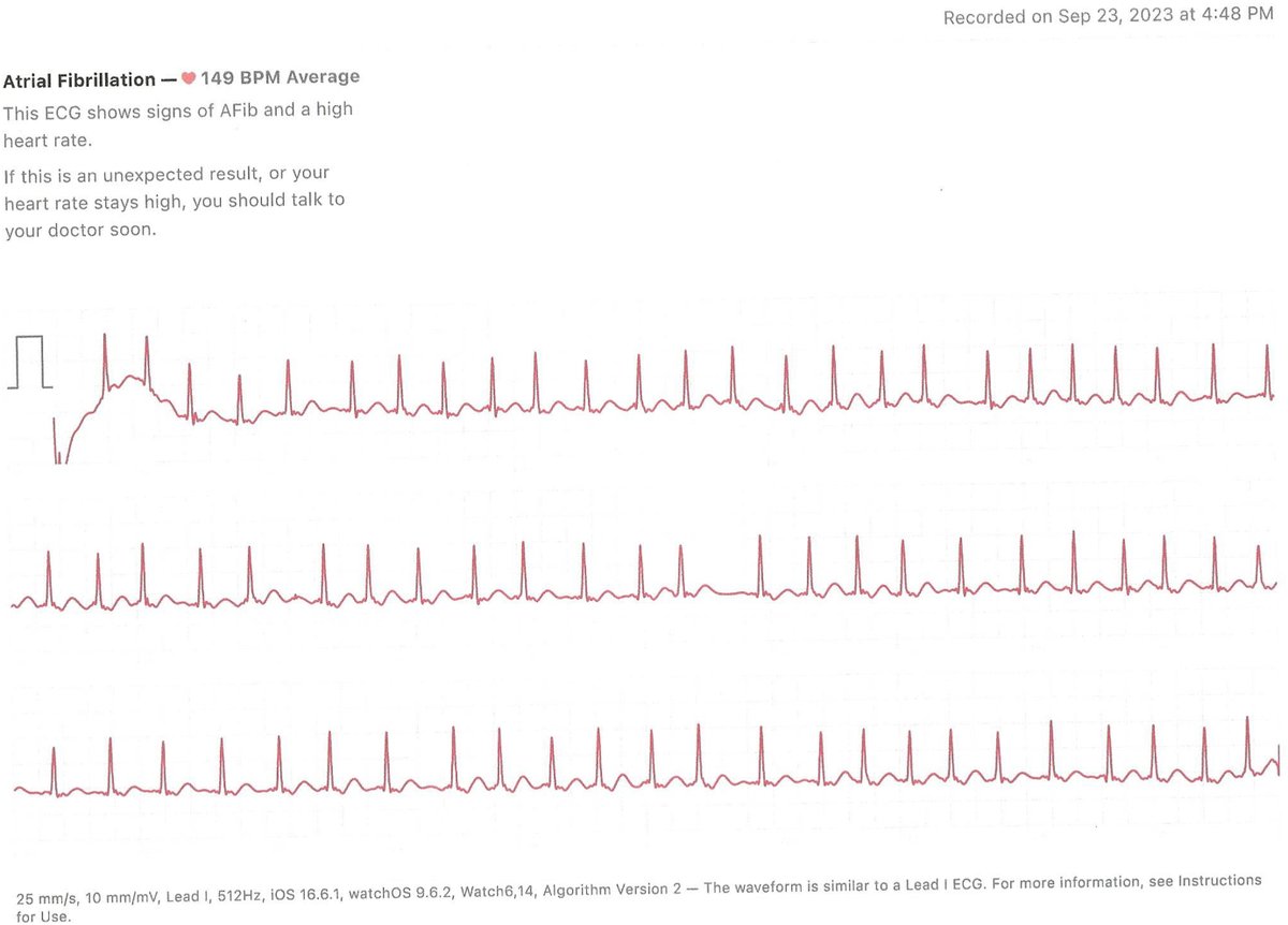 JNPNow's tweet image. A case focused on red imported fire ant bites with atrial fibrillation #dectection#waerabletech#afib#redants#NP
ow.ly/fkrB50RLJb4
