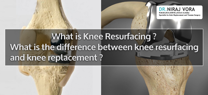 What is Knee Resurfacing? What is the difference between #KneeResurfacing & #kneeReplacement? Knee problems are common across all age groups in India with ageing population at most risk. the degenerative nature of Osteoarthritis causes.. Know more at: drnirajvora.com/blog/what-is-k…