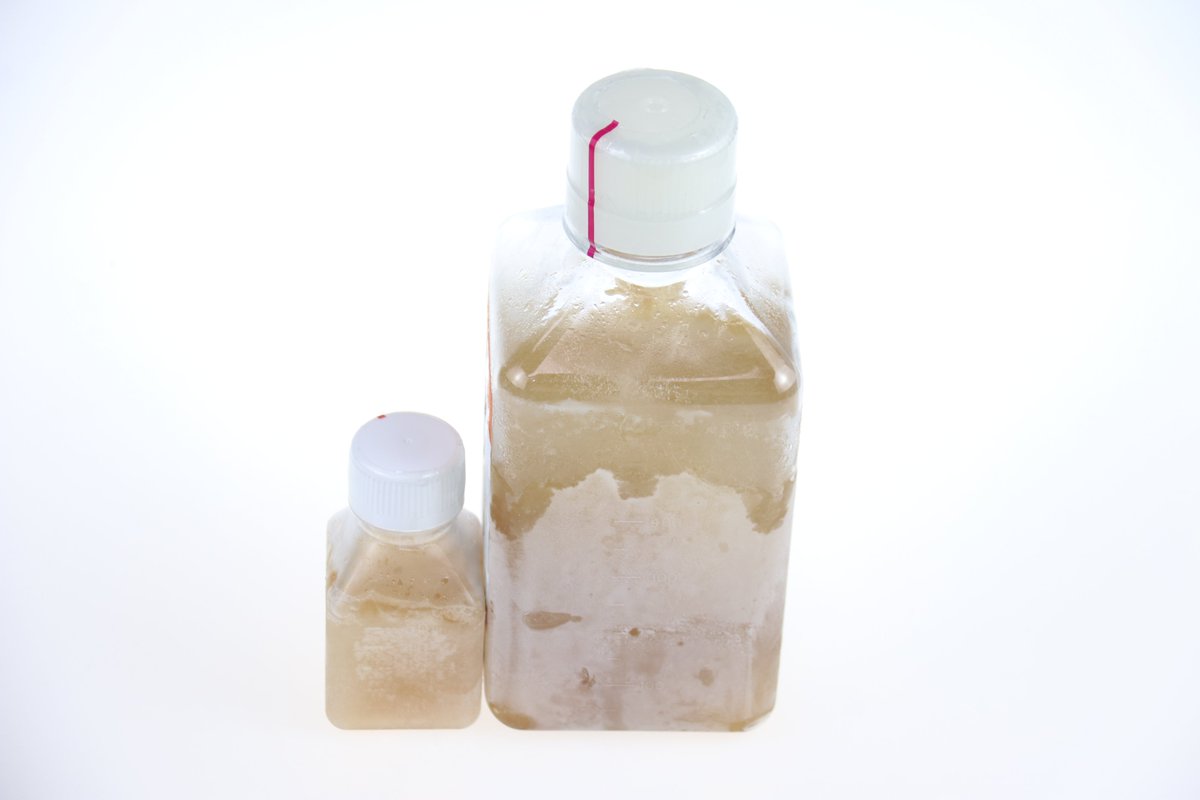 Global Kang 100ML 500ML Characterized Fetal Bovine Serum (FBS) cell culture media for stem cell serum and cell culture
#fetalbovineserum #fbs #cellculture #lifescience #labbottle #labbottles #reagentbottles #reagentbottle #animalserum #serum #plasticbottle #plasticbottles