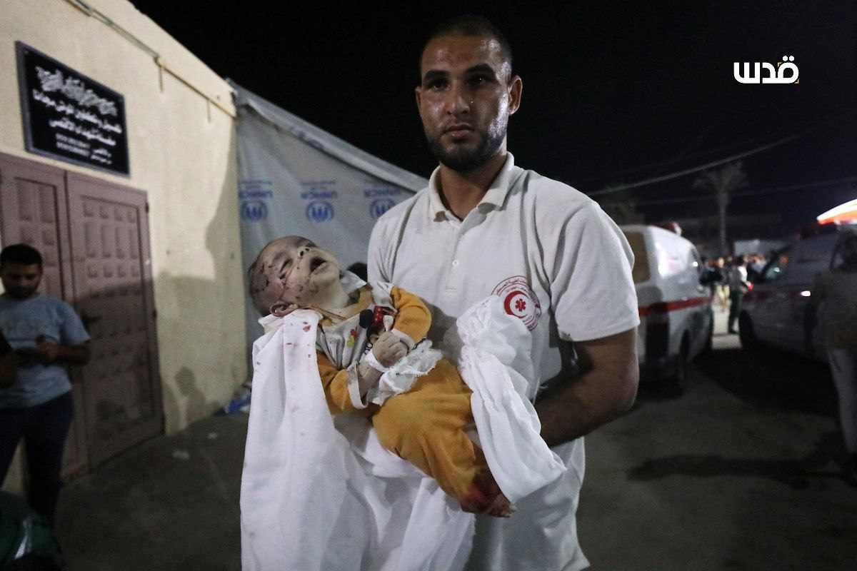 This innocent baby was one of the targets of the relentless Israeli attacks on Gaza last night.