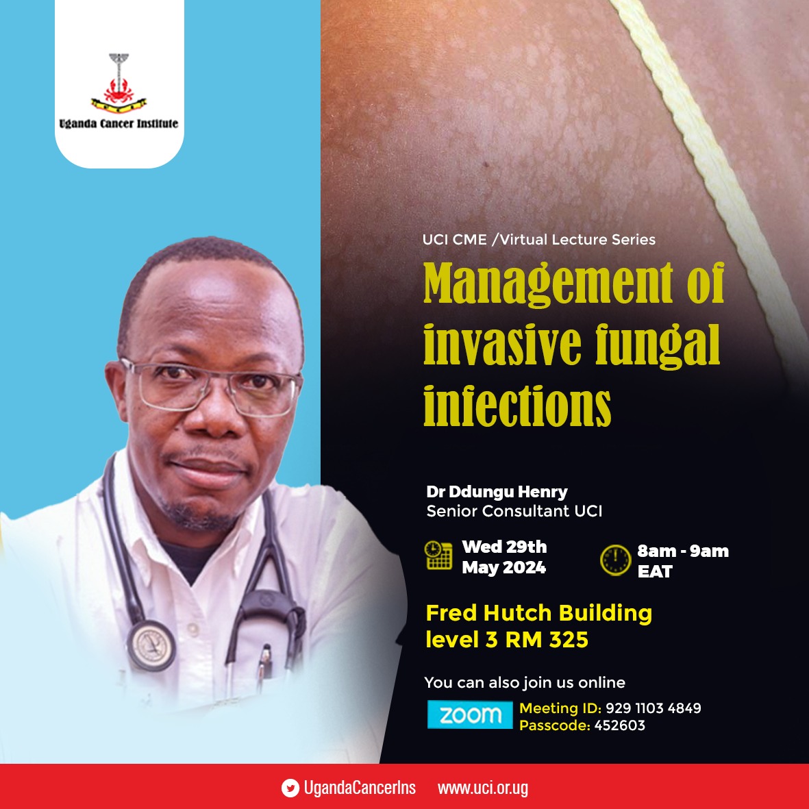 This week on UCI CME virtual lecture series: Dr. Henry Ddungu, Head Medical Oncology at UCI will be discussing Management of Invasive fungal infections. #See flyer for details. #FightCancerUg