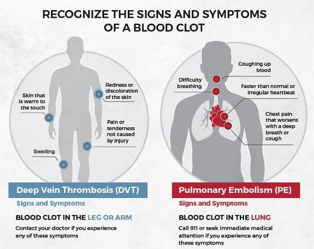 Blood clots are on the rise. The ones in the chest/lungs called pulmonary embolism (PE) are the ones that kill most and fastest.

If you or anyone develops sudden and unexpected chest tightness or loss of breath even if it lasts for a short time and disappears should immediately