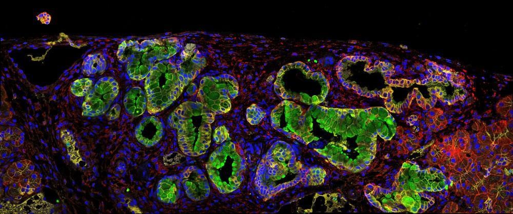 🔬Un estudio liderado por el #CSIC describe cómo las células madre del #cáncer de páncreas se aprovechan de una proteína para evadir al sistema inmune. Este hallazgo permitirá diseñar nuevas terapias que actúen contra la raíz de este tipo de cáncer. 👉bit.ly/44ZLPkH