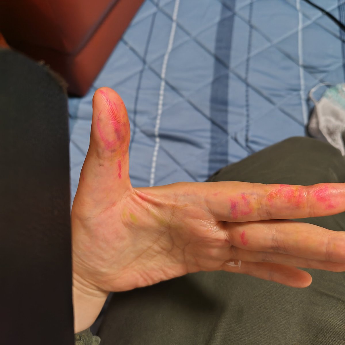 nibositolemon's tweet image. Hideous Divinity聴きながら仕事に行ってきた！
そしたら、手が真っ赤になった！😈
#HideousDivinity
@HDstreetteamJP 
@HideousDivinity