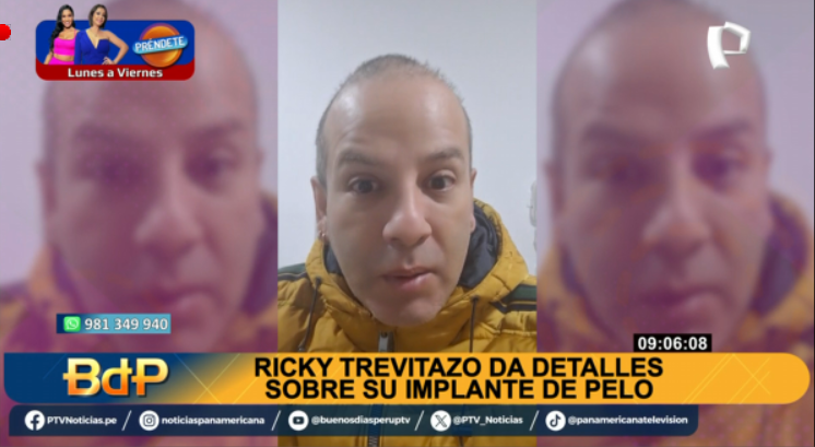 PanamericanaTV's tweet photo. #BDP #EnVivo | ¿POR QUÉ #RickyTrevitazo LUCE HINCHADO EN REDES? El cantante reveló que se realiza un tratamiento de implante capilar.
Míranos EN VIVO ►https://t.co/NDeYp3E0yA
#PanamericanaTelevisión https://t.co/dy1FNUzOcY