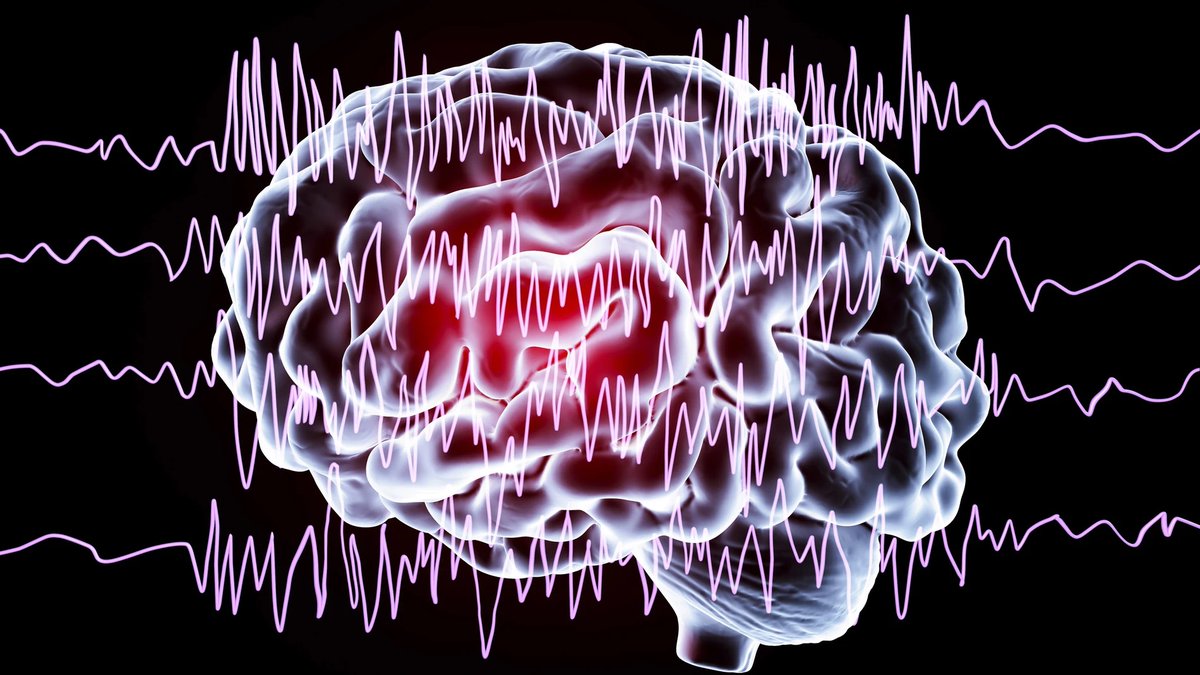 Los neurólogos instan a crear un 'Código Crisis' para tratar las crisis epilépticas, similar al 'Código Ictus' larazon.es/salud/neurolog…
#epilepsia #Neurologia