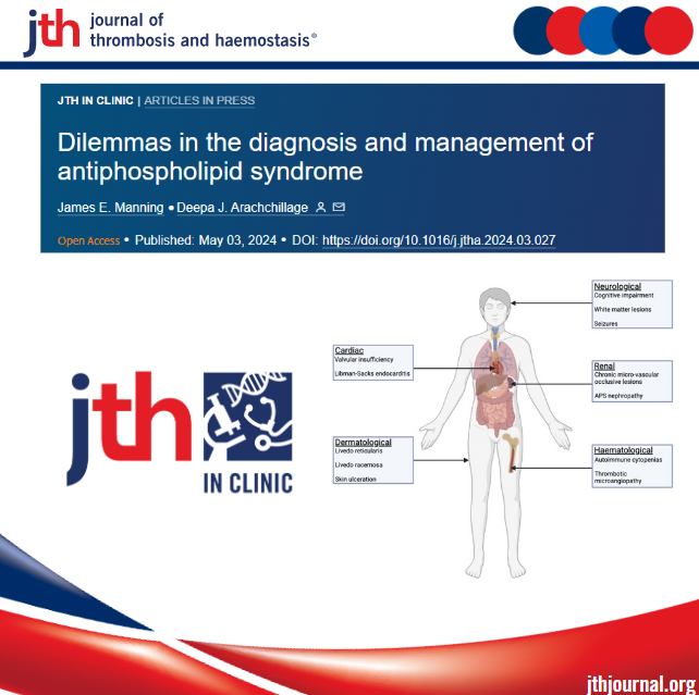 Antiphospholipid syndrome (APS) ▶️ #thrombosis (venous, arterial, or microvascular) and/or pregnancy morbidity ➕ positive antiphospholipid abs. New #JTHiC by @DeepaArachchil1 @connors_md #OpenAccess jthjournal.org/article/S1538-…