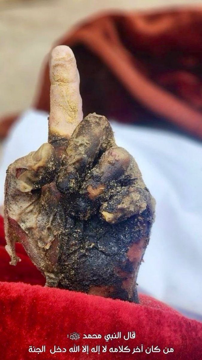 De ki: O, Allah'tır, bir tektir.
112/ İhlas, 1

 #RafahOnFire