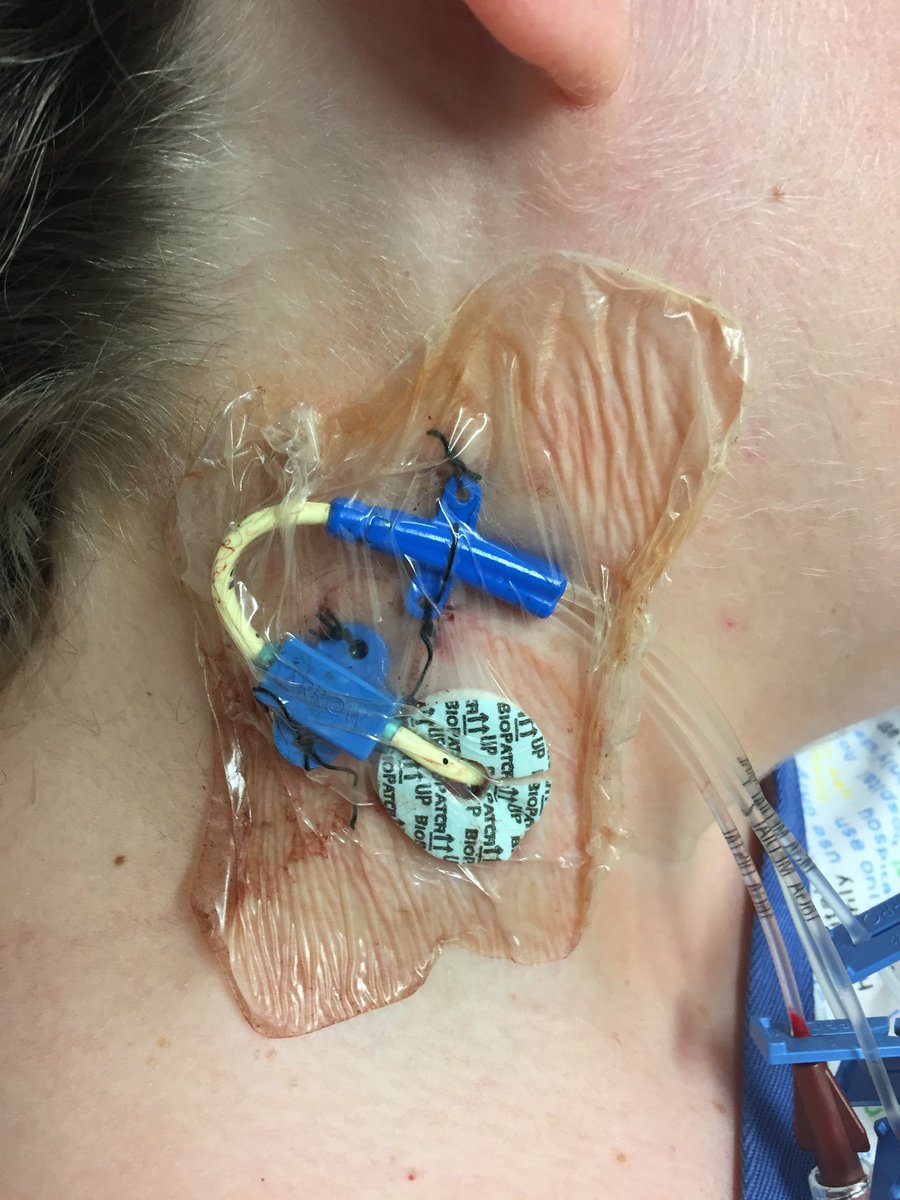 Doctors_GUILD's tweet photo. Name the procedure and it's uses?
#medtwitterWhat #Med_Intern https://t.co/wVm0UXDY4o