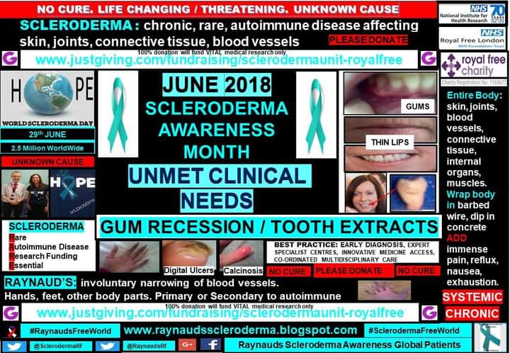 June #SclerodermaAwarenessMonth 🌻Flashback 2018 Unmet Clinical Need: Gum Recession and Tooth Loss: 
blog.raynaudsscleroderma.co.uk/2018/05/gum-re… 
Read more royalfreecharity.org/news/fundraisi… 
 #SclerodermaFreeWorld #RaynaudsFreeWorld 
#Research #Scleroderma #SystemicSclerosis #Raynauds #Autoimmune #RareDisease