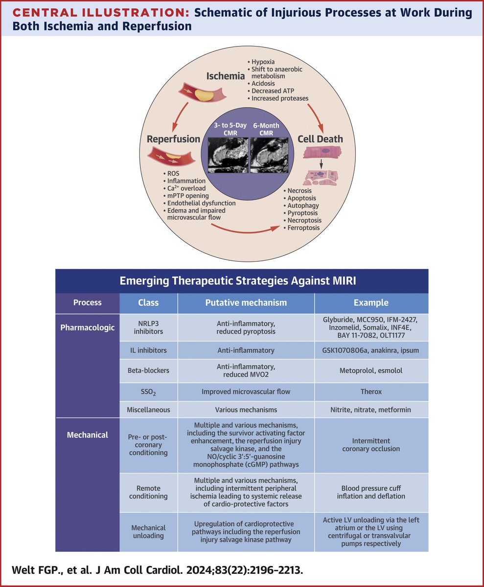 🔴 Reperfusion Injury in Patients With Acute Myocardial Infarction: 2024 JACC Scientific Statement #openaccess  

jacc.org/doi/10.1016/j.…
#Cardiology  #CardioTwitter #MedEd #medical #medtwitter #cardiotwiteros #CardioEd #Cardiox