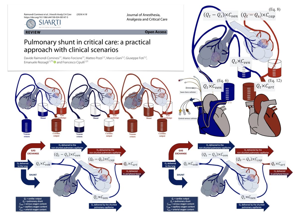 Pulmonary shunt in critical care, practical approach w clinical scenarios
📚 background
🫀🫁definitions: shunt, ventilation/perfusion mismatch, dead space
🩸O2 blood content
🫁 pulmonary shunt
🛏️ shunt measurement in practice
🔮 future directions
#FOAMcc
🔓rdcu.be/dI9kN