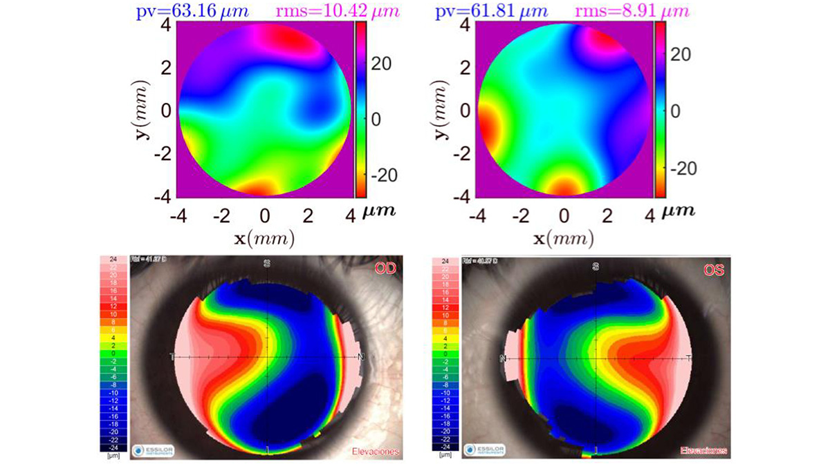 Via #OPG_OPTCON: Corneal topography using a smartphone-based corneal topographer considering a biconical model for the corneal surface ow.ly/PcYU50RPtf1 #TransparentPeerReview #Instrumentation @inaoe_mx @ICATUNAM