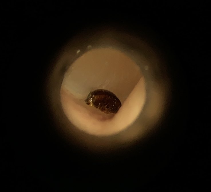 Olivier Picard (@olivierpicarduk) on Twitter photo When a patient comes in to the pharmacy at a very busy time and tells you an insect 🐜 jumped in their ear. Whatever... <a href="/TympaHealth/">TympaHealth</a> <a href="/NPA1921/">National Pharmacy Association</a>
We eventually got it out 😅 When a patient comes in to the pharmacy at a very busy time and tells you an insect 🐜 jumped in their ear. Whatever... <a href="/TympaHealth/">TympaHealth</a> <a href="/NPA1921/">National Pharmacy Association</a>
We eventually got it out 😅
