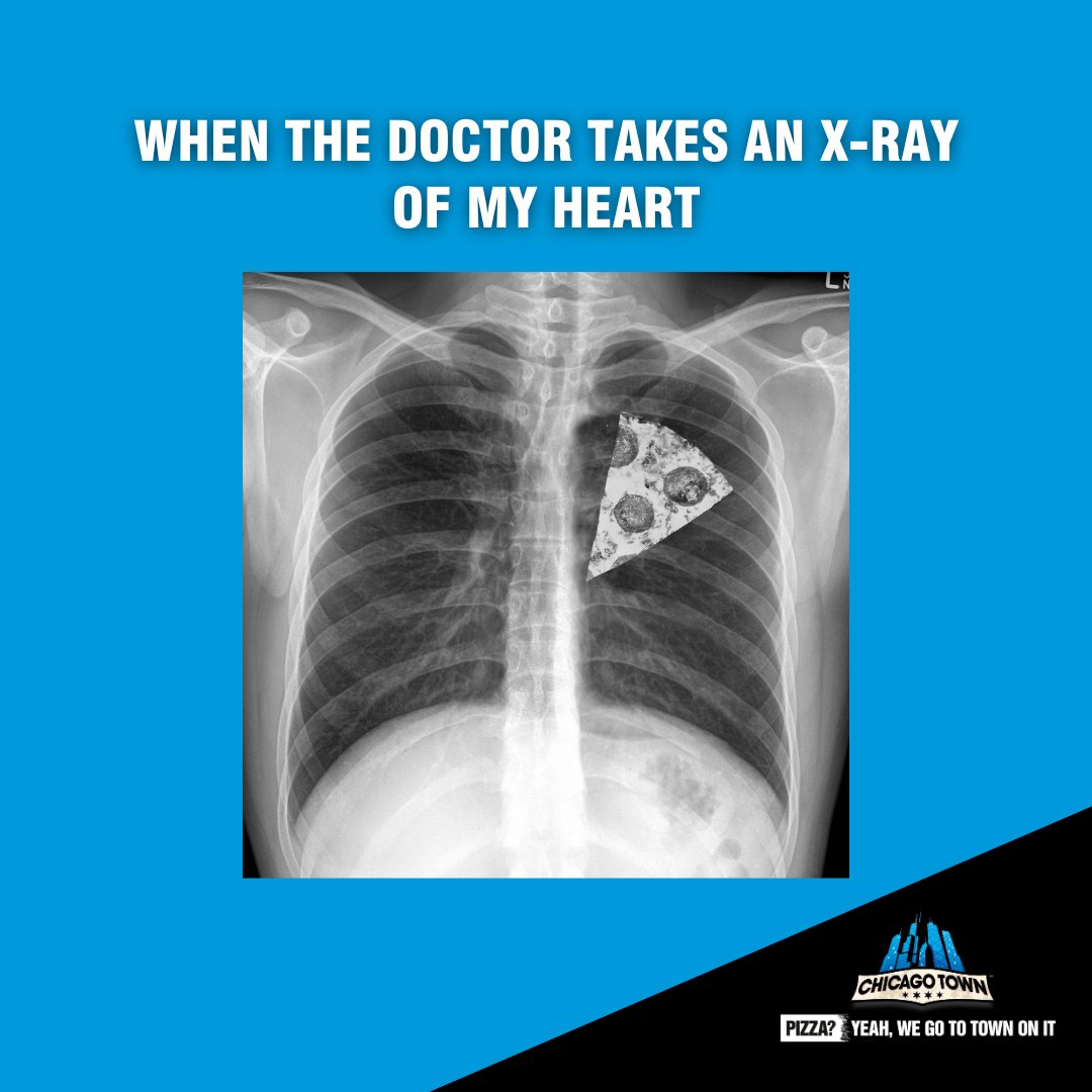 a pizza my heart 💙 💙 💙 

#chicagotown #pizza #veganpizza #toppings #pizzatime #pizzalover #instafood #pizzagram #dailypizza #foodie #yummy #tasty #takeaway