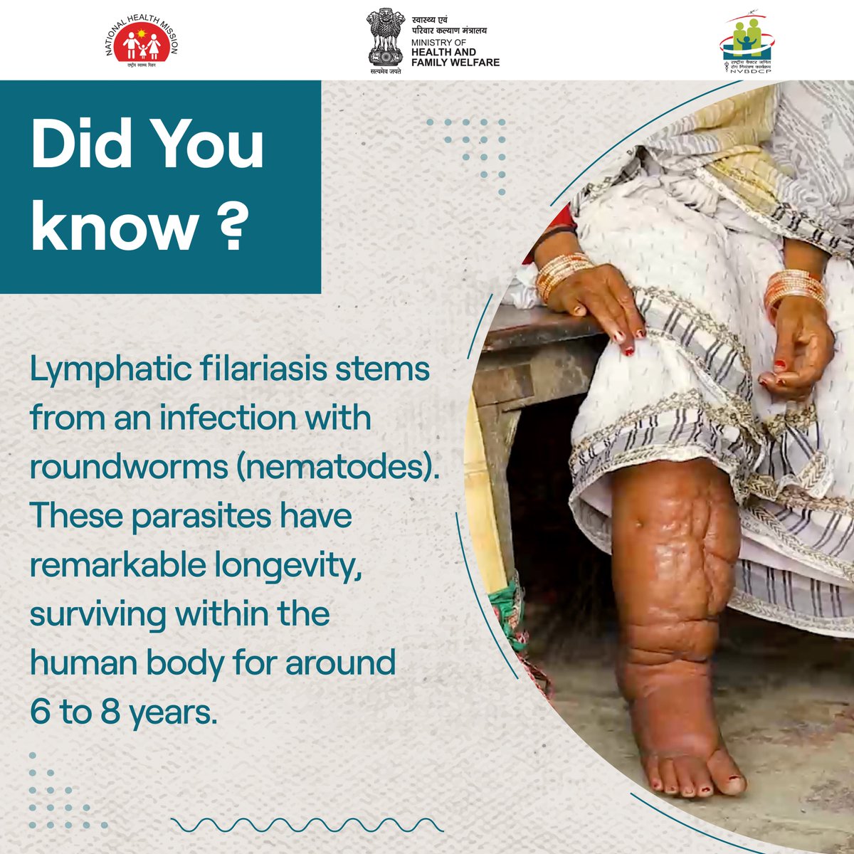 ये कीट कई छोटे लार्वा पैदा करते हैं, जो खून में घूमते रहते हैं और संक्रमण का चक्र जारी रखते हैं। ये कीट लसीका प्रणाली (lymphatic system) को प्रभावित करते हैं।

बीमारी के फैलाव को रोकने के लिए सरकार द्वारा किये गए प्रयासों का सहयोग ज़रूर करें।

#NTDFreeIndia #LFFreeIndia #BeatNTDs