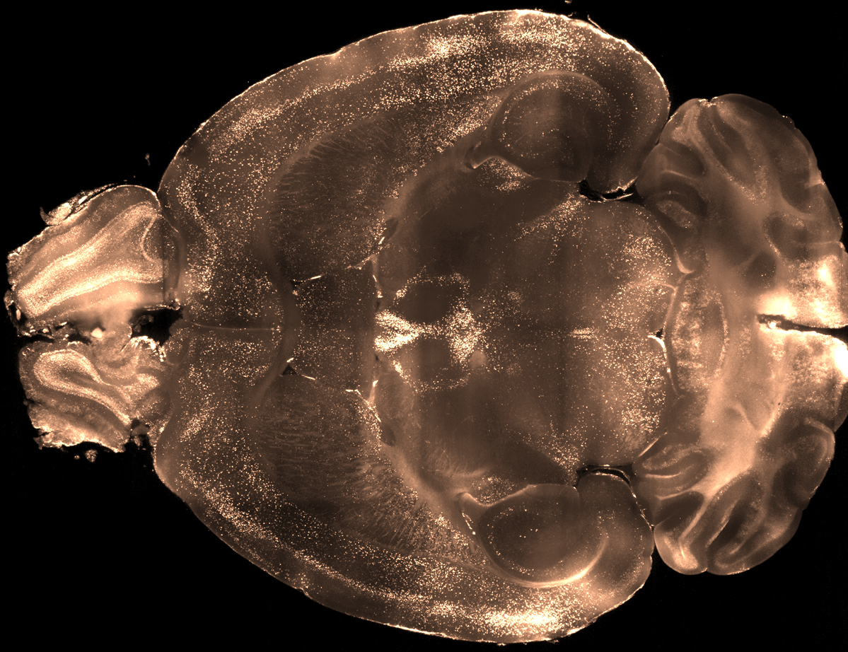 Alex Kwan 關進晞 (@kwanalexc) on Twitter photo Can whole-brain imaging of cellular c-Fos signals be used for #psychedelics drug discovery?
This was a project led by <a href="/aboharbf/">Farid Aboharb</a> and <a href="/PashaDavoudian/">Pasha Davoudian</a>, where they tested a panel of drugs and developed a machine learning pipeline to classify.
biorxiv.org/content/10.110… Can whole-brain imaging of cellular c-Fos signals be used for #psychedelics drug discovery?
This was a project led by <a href="/aboharbf/">Farid Aboharb</a> and <a href="/PashaDavoudian/">Pasha Davoudian</a>, where they tested a panel of drugs and developed a machine learning pipeline to classify.
biorxiv.org/content/10.110…