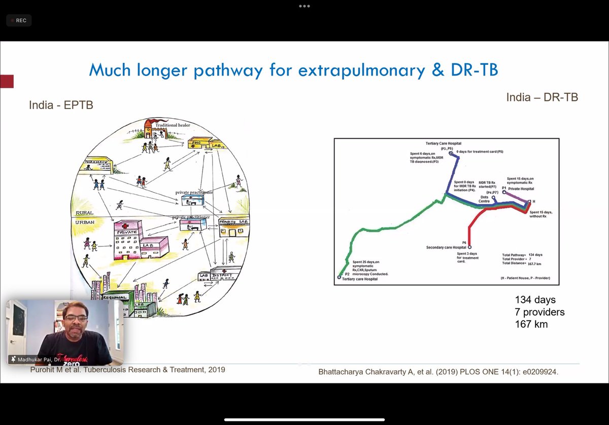 drswathikrishna's tweet photo. @paimadhu speaks about the harrowing journey of #PwTB, diagnostic delays and the need for research & development as well as advocacy for advanced, cost effective TB diagnostics, in his inaugural talk for the @McGill_TB Advanced TB Diagnostics course https://t.co/2oP0YbX3jW