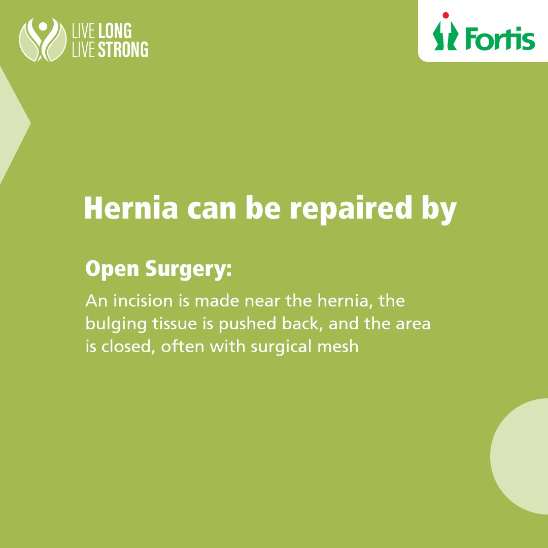 fortis_hospital's tweet photo. A hernia might be indicated by a visible lump that appears and disappears. You may be more likely to develop a hernia if you- lift heavy objects, sneeze frequently, have chronic constipation, have obesity (BMI > 30). Consult our experts to #LiveLongLiveStrong.
#AtFortisWeCare https://t.co/nrE2ReoDqs